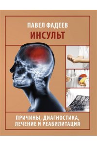 Фадеев П.А. Инсульт. Причины, диагностика, лечение и реабилитация